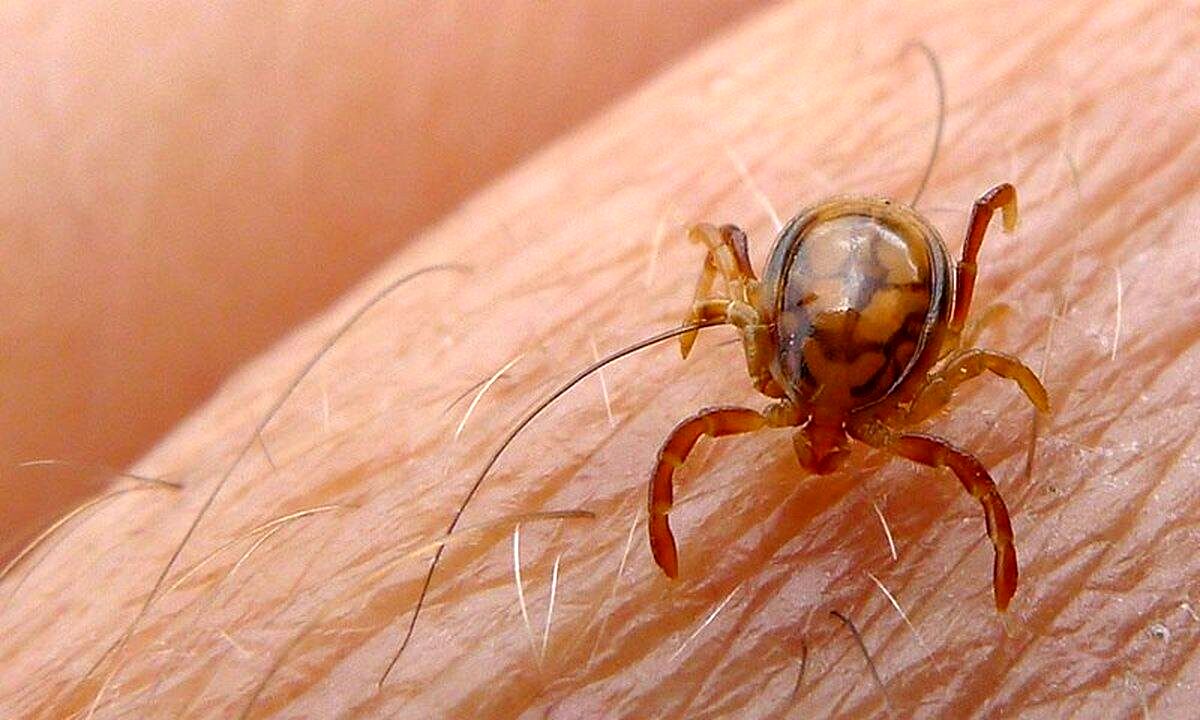 علائم تب کریمه کنگو