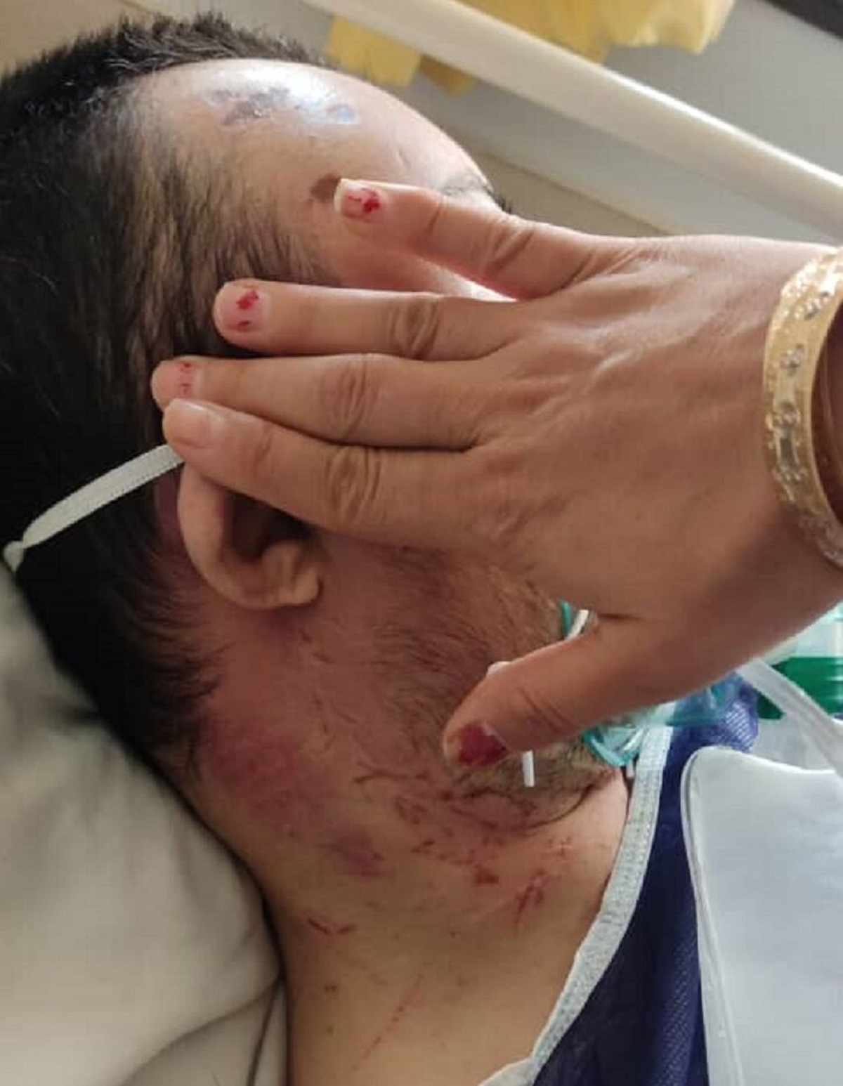 ضرب و شتم شدید یک معلول در مرکز بهزیستی/ ماجرا چیست؟