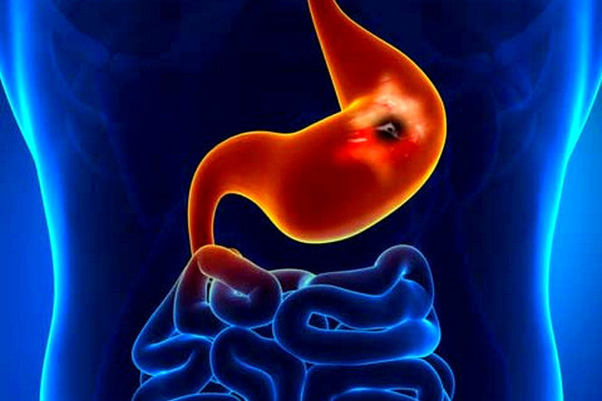 غذا‌هایی که میکروب معده را از بین می‌برند