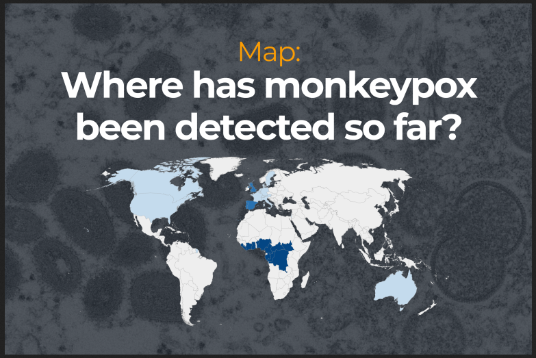 شیوع آبله میمون؛ کدام کشور‌ها درگیر شده‌اند؟