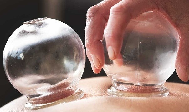 ۲۴ فایده انجام حجامت بر سلامت بدن