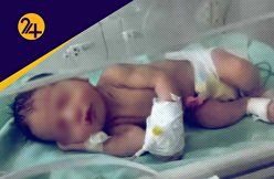 رشد بالای سقط جنین در ایران / یک کارشناس: آمار نوزادان رها شده افزایش زیادی داشته است