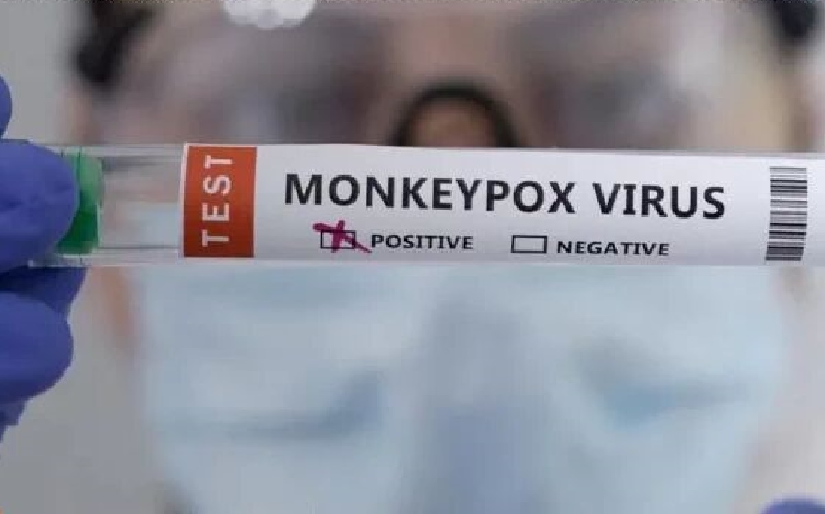 تامین کیت‌های غربالگری آبله میمونی در انستیتو پاستور