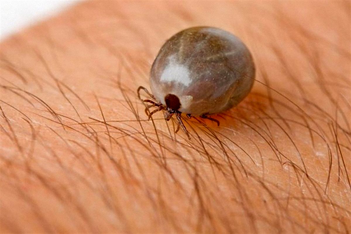 علائم تب کریمه کنگو علائم تب کریمه کنگو