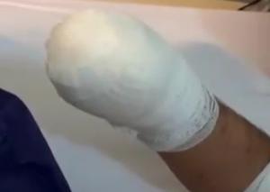 ماجرای قطع دست بیمار در مرکز ترک اعتیاد شیراز چه بود؟