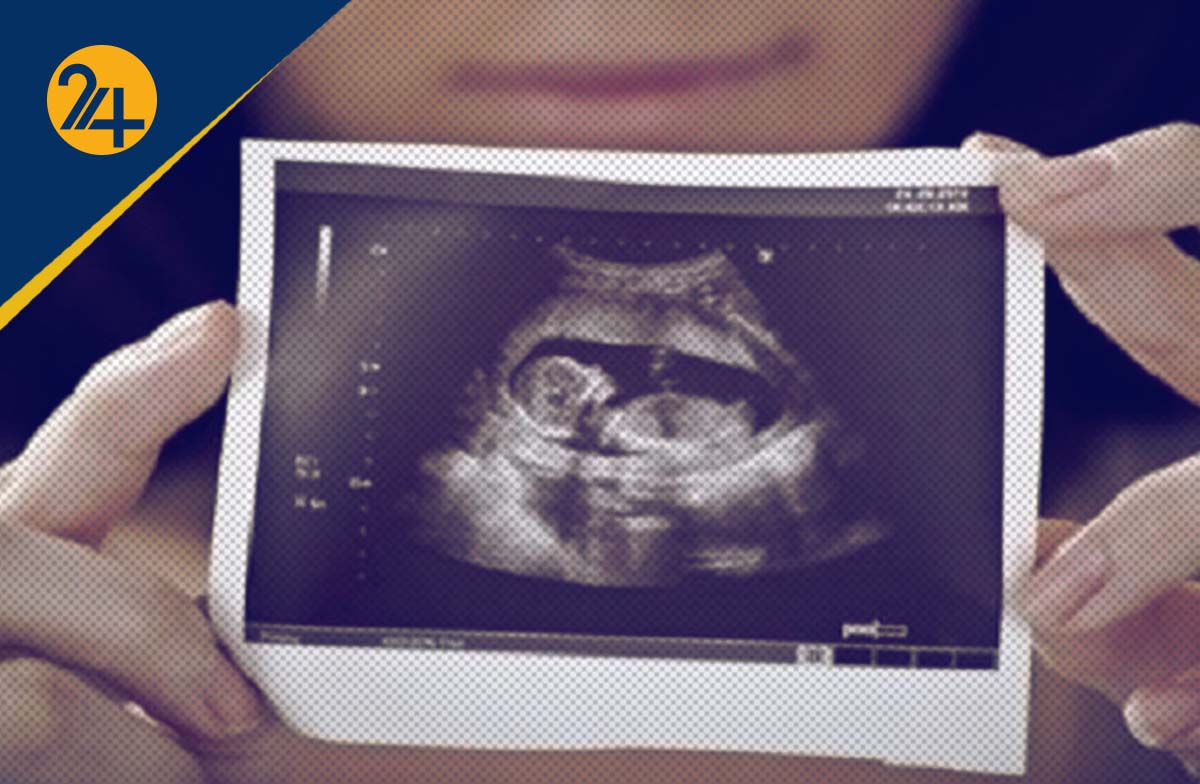 غربالگری جنین غربالگری جنین