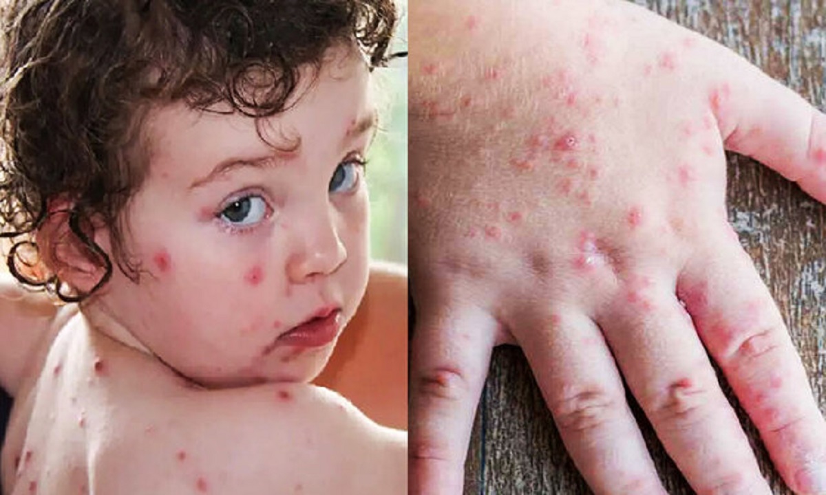 آنفلوآنزای گوجه‌فرنگی