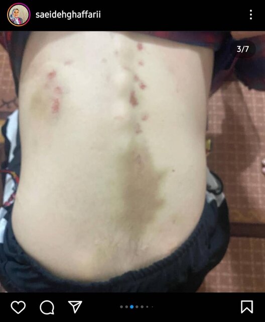 پیگیری قضایی و ورود بهزیستی به پرونده ربایش و آزار بیمار اتیسمی پیگیری قضایی و ورود بهزیستی به پرونده ربایش و آزار بیمار اتیسمی