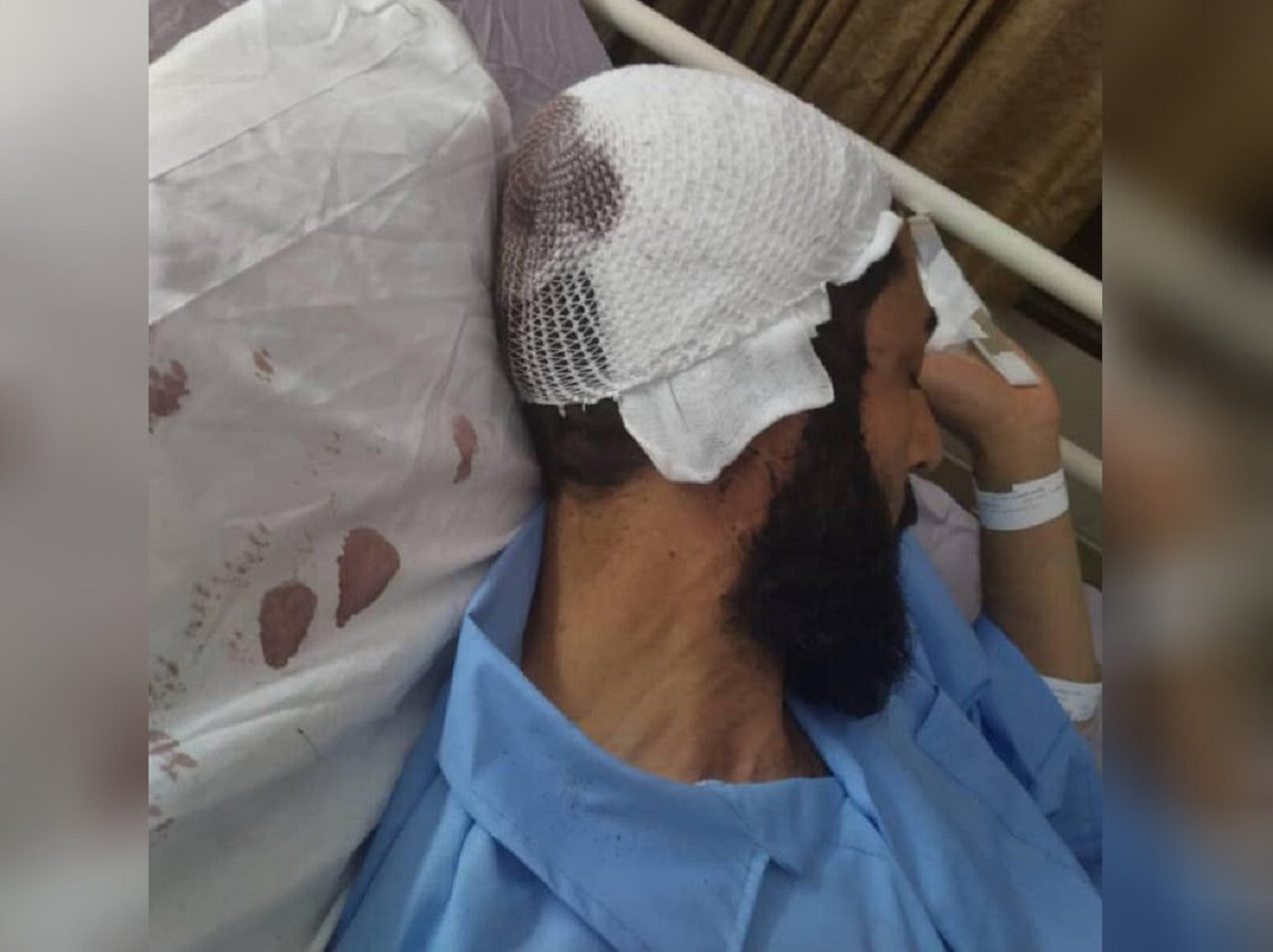 حمله به ۲ روحانی در قم