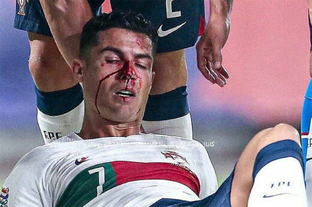 لحظه مصدومیت رونالدو