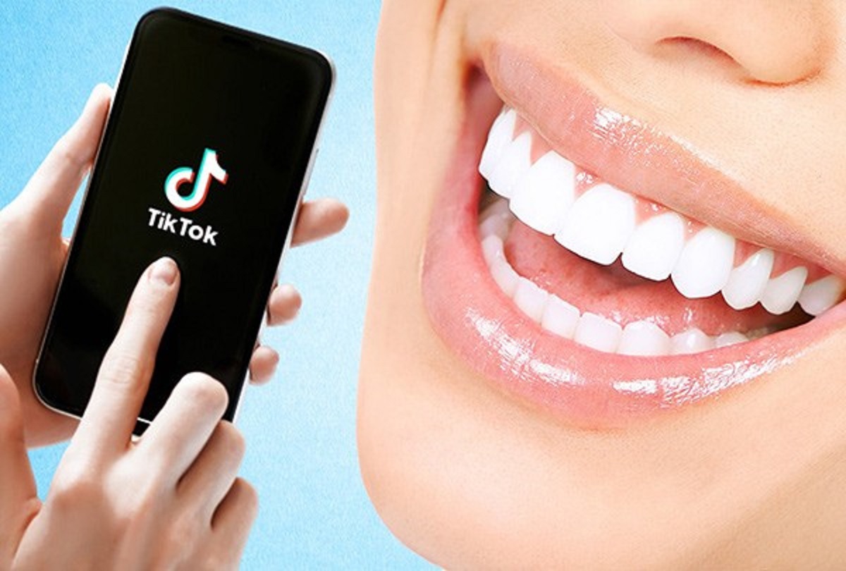 سفید کردن دندان با وایتکس