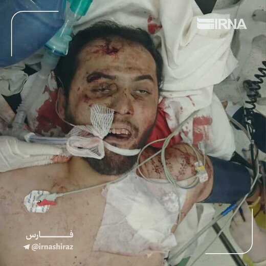 تصاویر وحشتناک از عامل تروریستی حرم شاهچراغ (ع) در بیمارستان