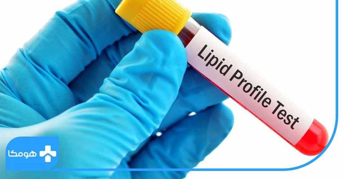 ضرورت انجام تست چربی خون برای افراد! ضرورت انجام تست چربی خون برای افراد!