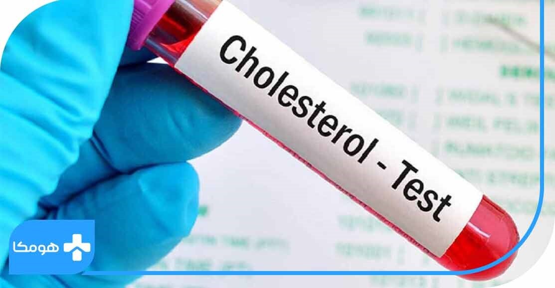 ضرورت انجام تست چربی خون برای افراد! ضرورت انجام تست چربی خون برای افراد!
