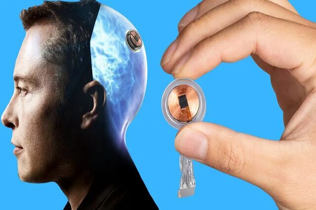 کاشت تراشه در مغز توسط شرکت ایلان ماسک