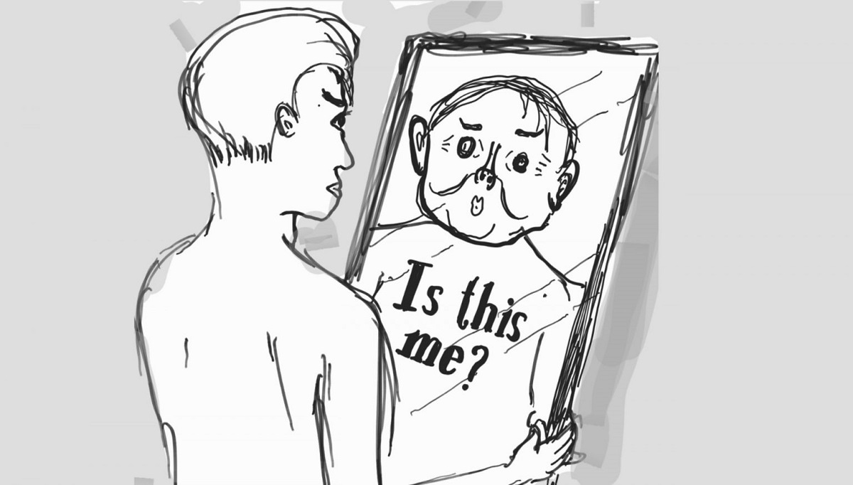 اختلال خود زشت پنداری