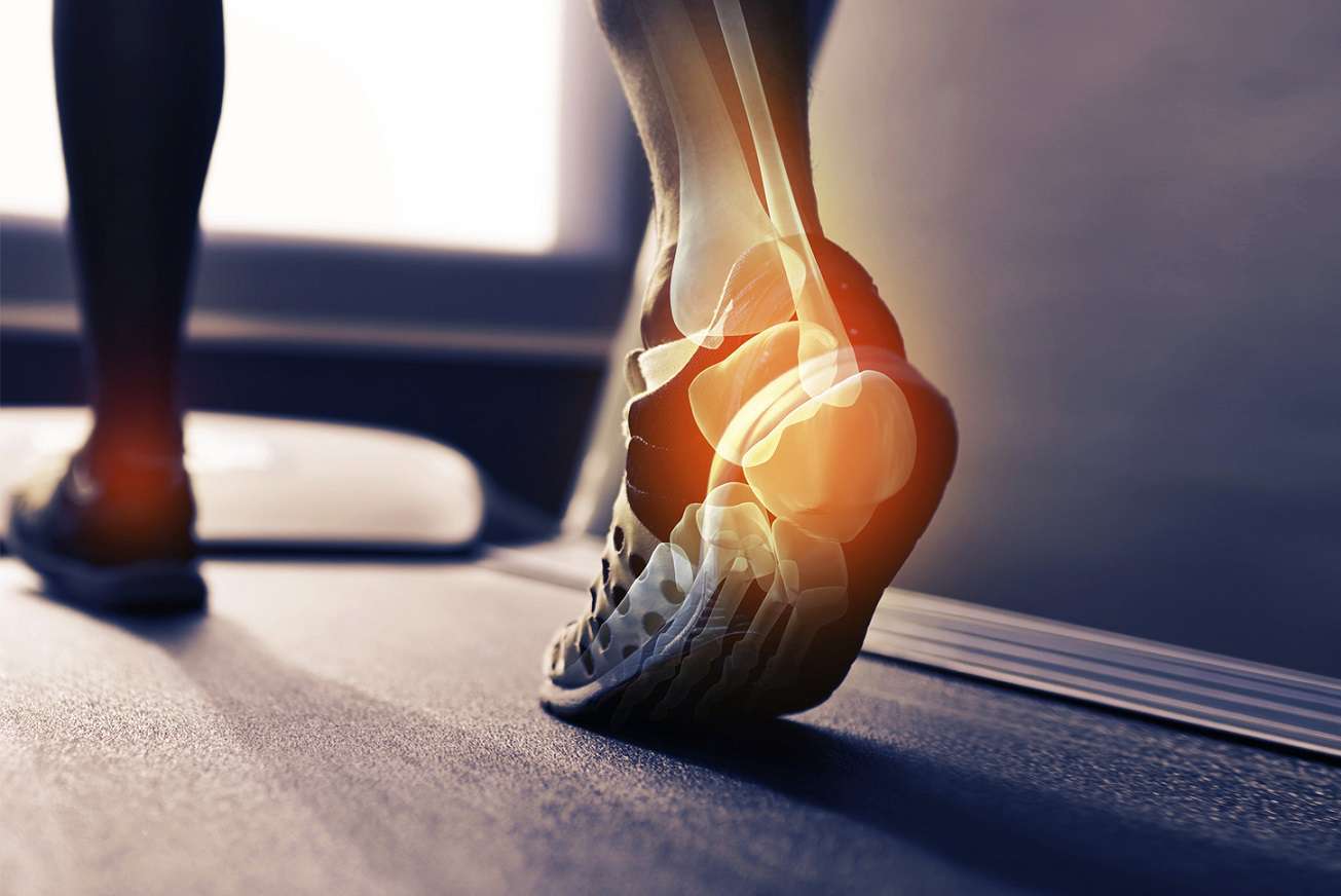 انواع اختلال در راه رفتن انواع اختلال در راه رفتن