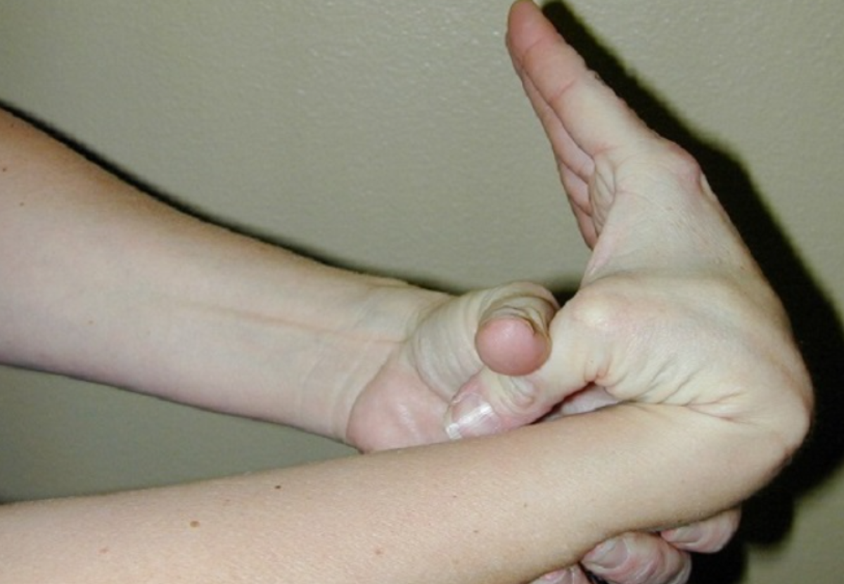 آیا نرمی استخوان خطرناک است؟