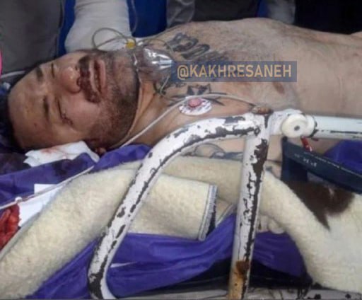 اولین تصاویر از هانی کرده در اورژانس بعد از تیر خوردن