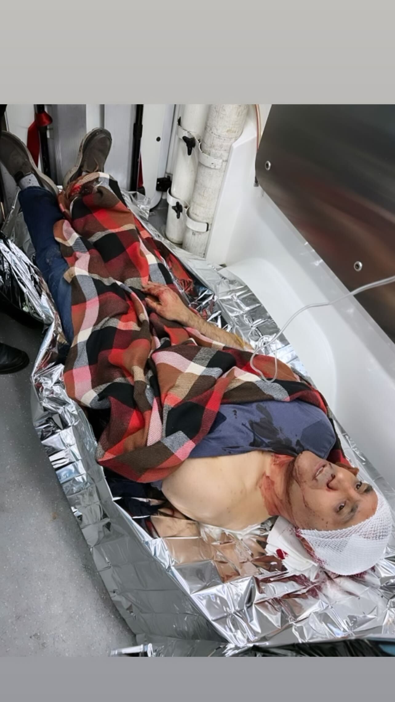 تصاویر دلخراش از حمله اراذل به بازیگر تلویزیون تصاویر دلخراش از حمله اراذل به بازیگر تلویزیون