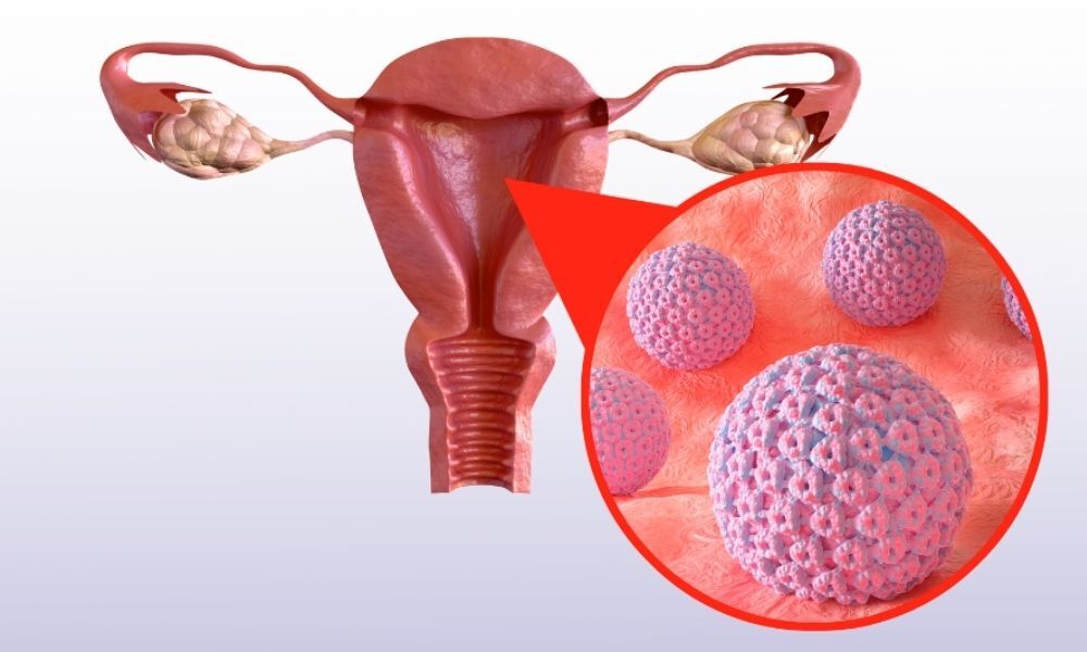 انواع ویروس HPV کدام است؟
