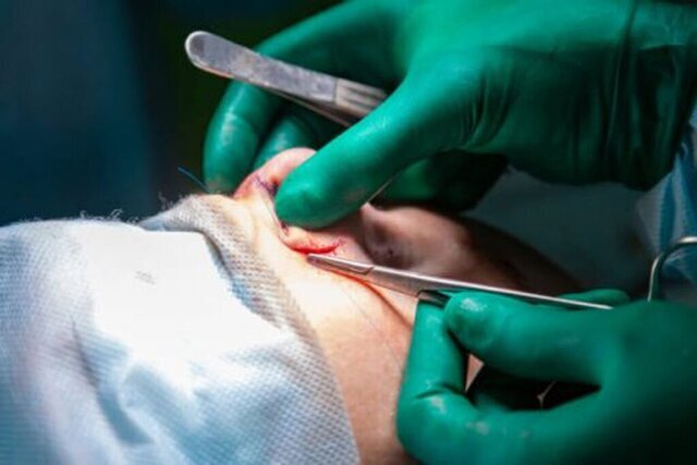 جراحی زیبایی