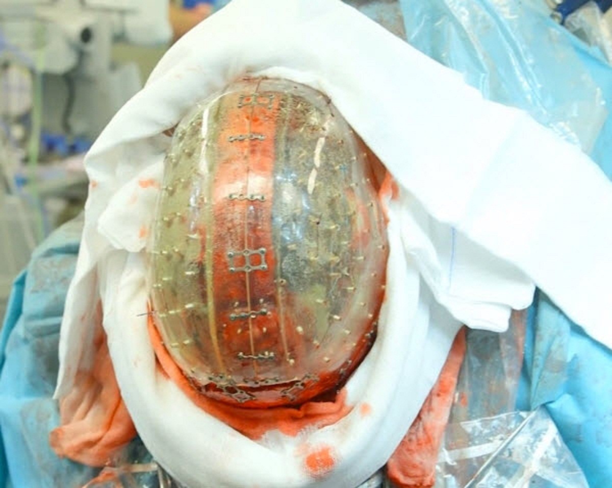 جمجمه مصنوعی جمجمه مصنوعی