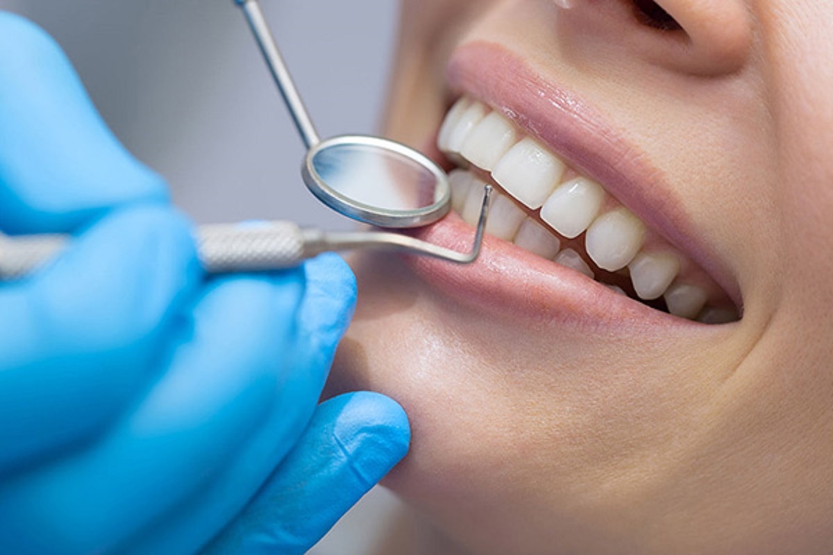 آمار بالای دندان‌های خراب ایرانی‌ها/ کشیدن دندان؛ تنها گزینه مردم
