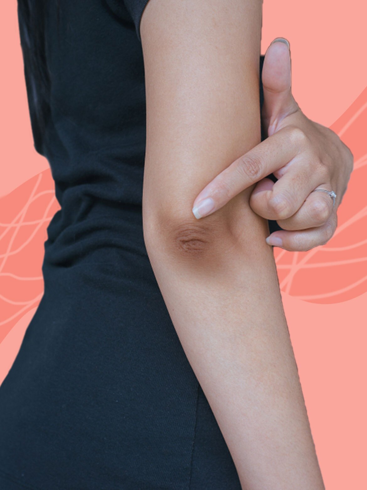 راه‌هایی برای از بین‌‎بردن تیرگی آرنج