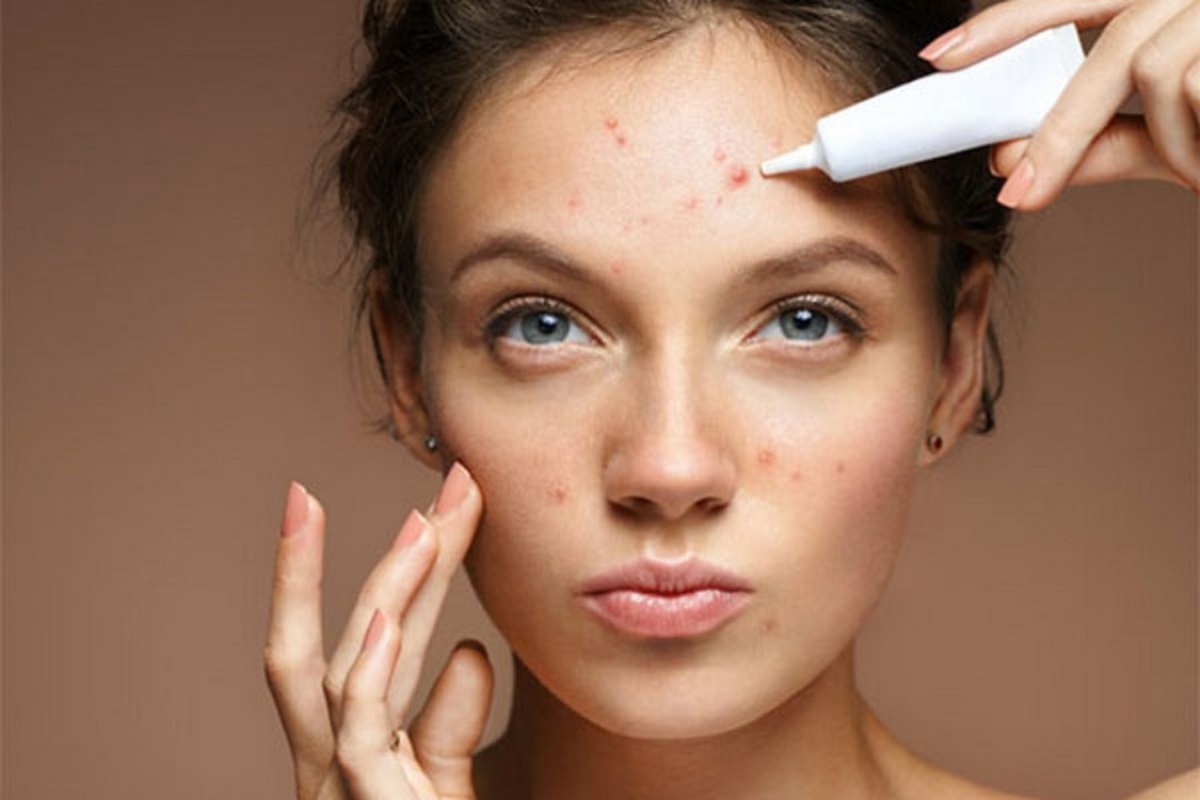 ۶ راه جلوگیری از آکنه پوست خشک
