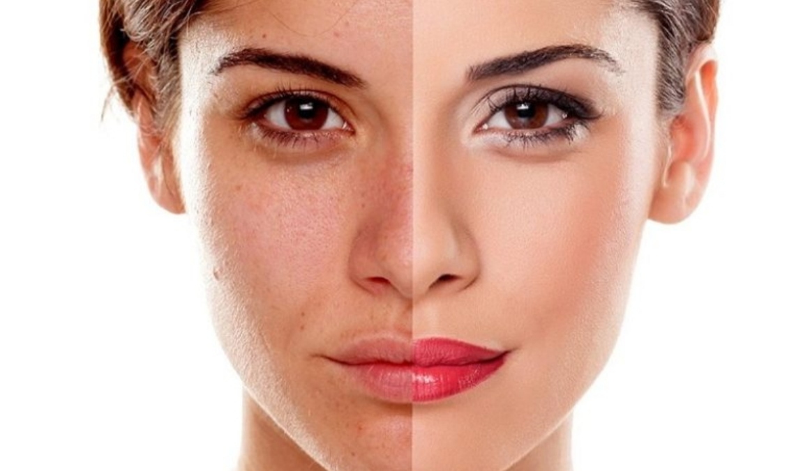 علت و درمان ضخیم شدن پوست صورت‌