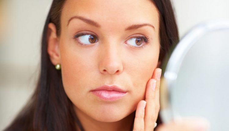 درمان فوری آکنه و جوش