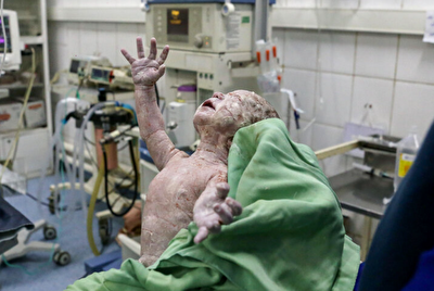 مامایی و لحظه‌های شوق و لبخند