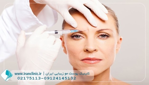 ده نکته ی طلایی در مورد تزریق بوتاکس ده نکته ی طلایی در مورد تزریق بوتاکس