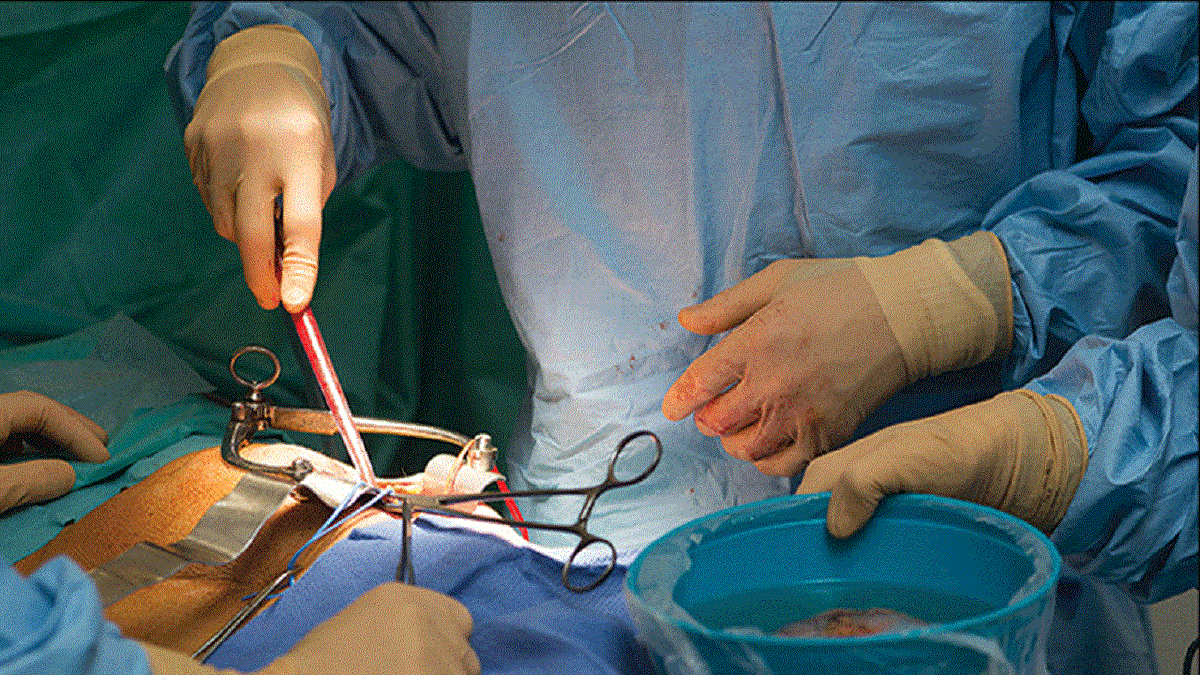 ممنوعیت پیوند کلیه ایرانیان به اتباع خارجی