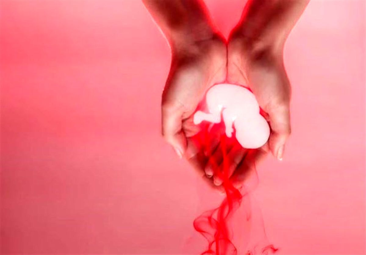 سقط جنین خود به خودی و علت آن