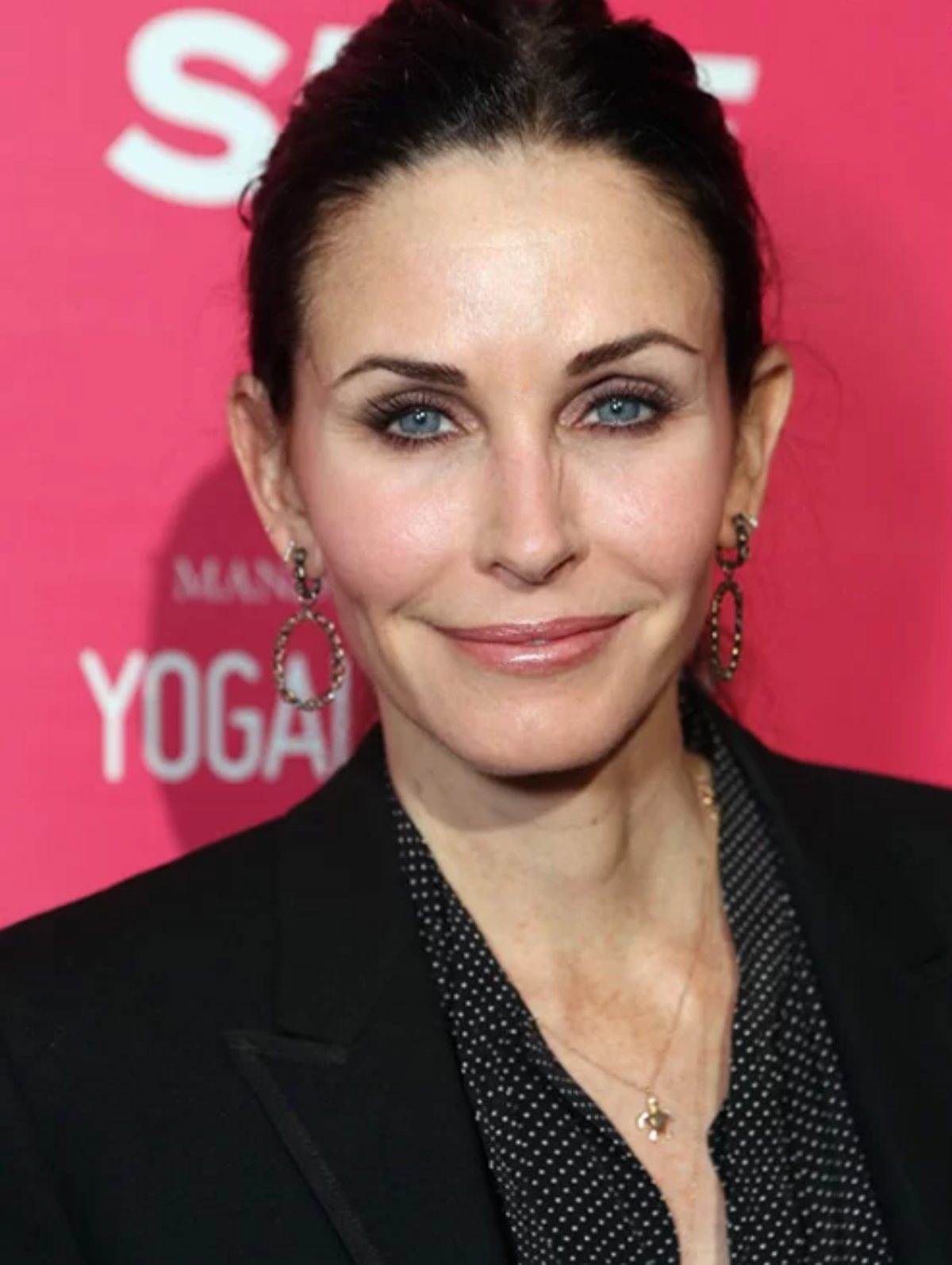 بازیگر سریال فرندز: با تزریق بیش از حد چهره‌ام را داغون کردم! + عکس