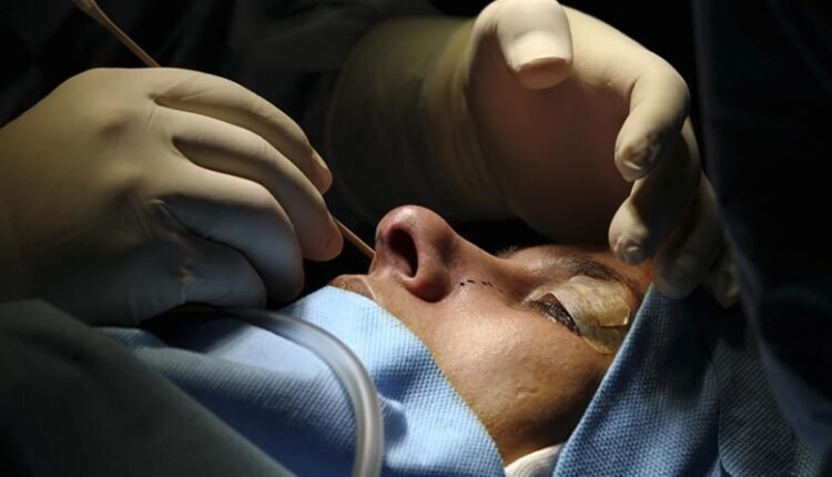 عمل جراحی بینی