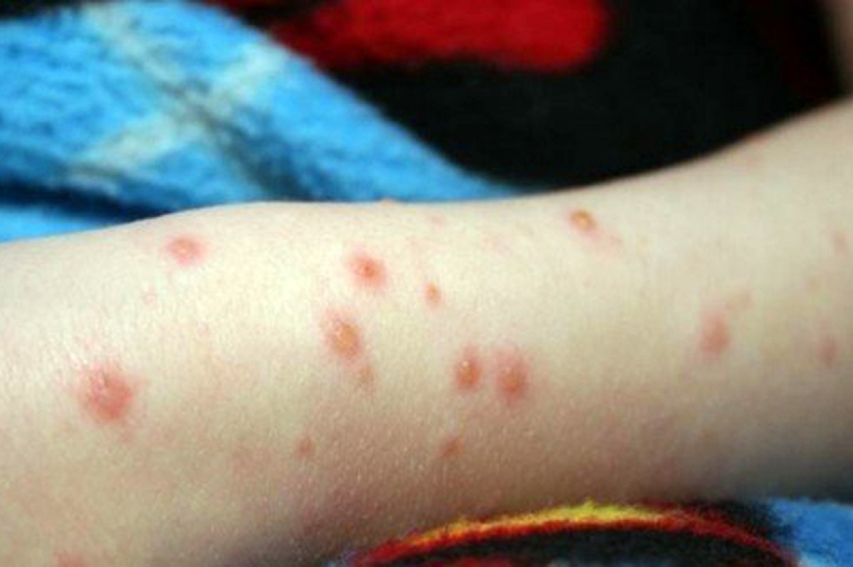 نگرانی از افزایش یک بیماری در ایران؛ لبنیات غیرپاستوریزه مصرف نکنید