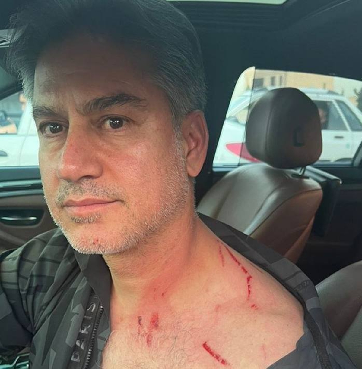 حمله سه موتورسوار به مربی تیم ملی/ گردنبند مطهری به سرقت رفت