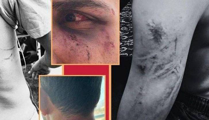 پشتپرده حمله به گردشگران در «اوپرت» با سلاح گرم و شوکر چه بود؟ پشتپرده حمله به گردشگران در «اوپرت» با سلاح گرم و شوکر چه بود؟