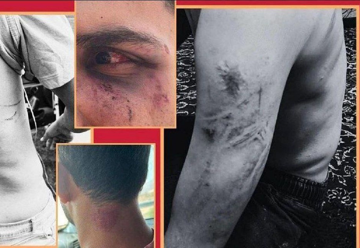 روایت یک شاهد عینی از جزئیات حمله افراد ناشناس به گردشگران اوپرت