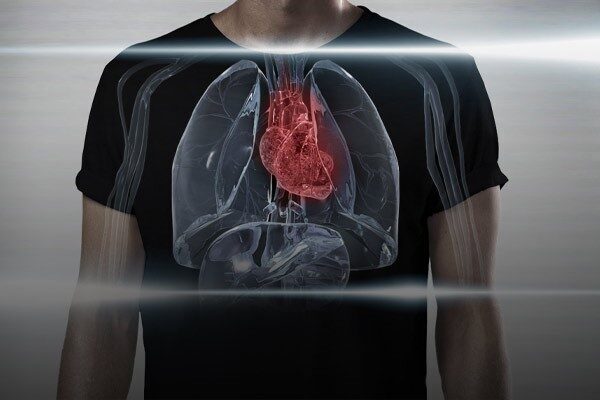 بیماری قلبی مادرزادی vsd چیست؟ بیماری قلبی مادرزادی vsd چیست؟