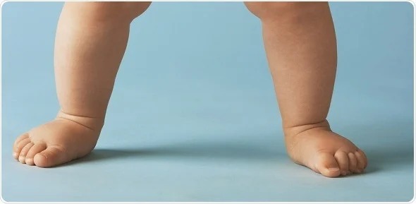 راه‌های تشخیص صافی کف پا در کودکان