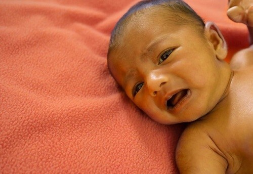 جلوگیری از زردی نوزاد جلوگیری از زردی نوزاد