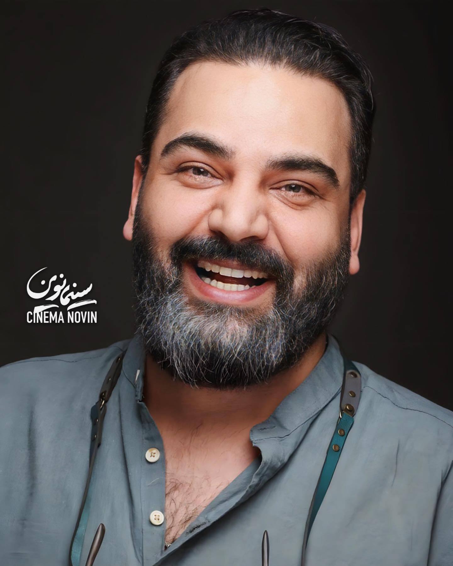 احسان علیخانی تغییر چهره داد!