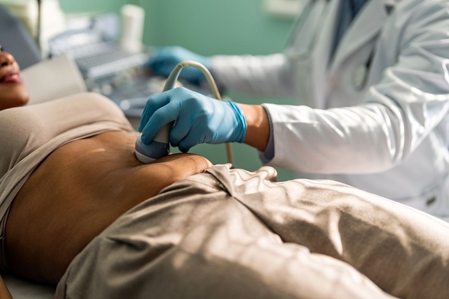 کیست شکلاتی چیست؟