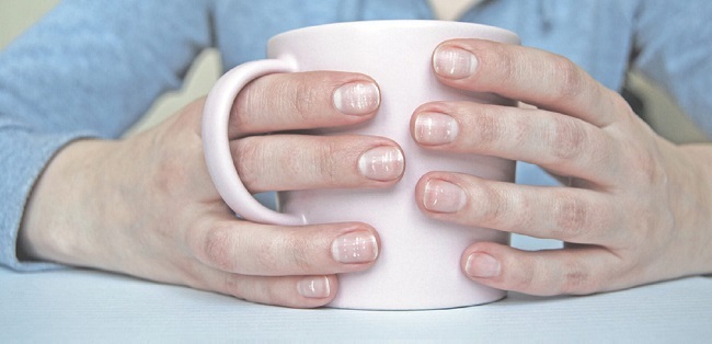 دلایل لکههای سفید روی ناخن دلایل لکههای سفید روی ناخن