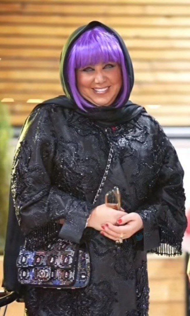 چهر جدید بهنوش بختیاری همه را متعجب کرد +عکس