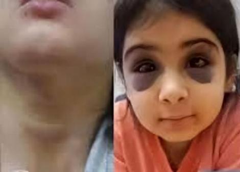 جزئیات هولناک از شکنجه دختر سنندجی توسط نامادری